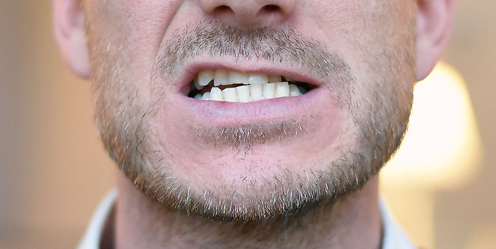 nær ved Panter akavet At skære tænder kan være et tegn på stress - Martil